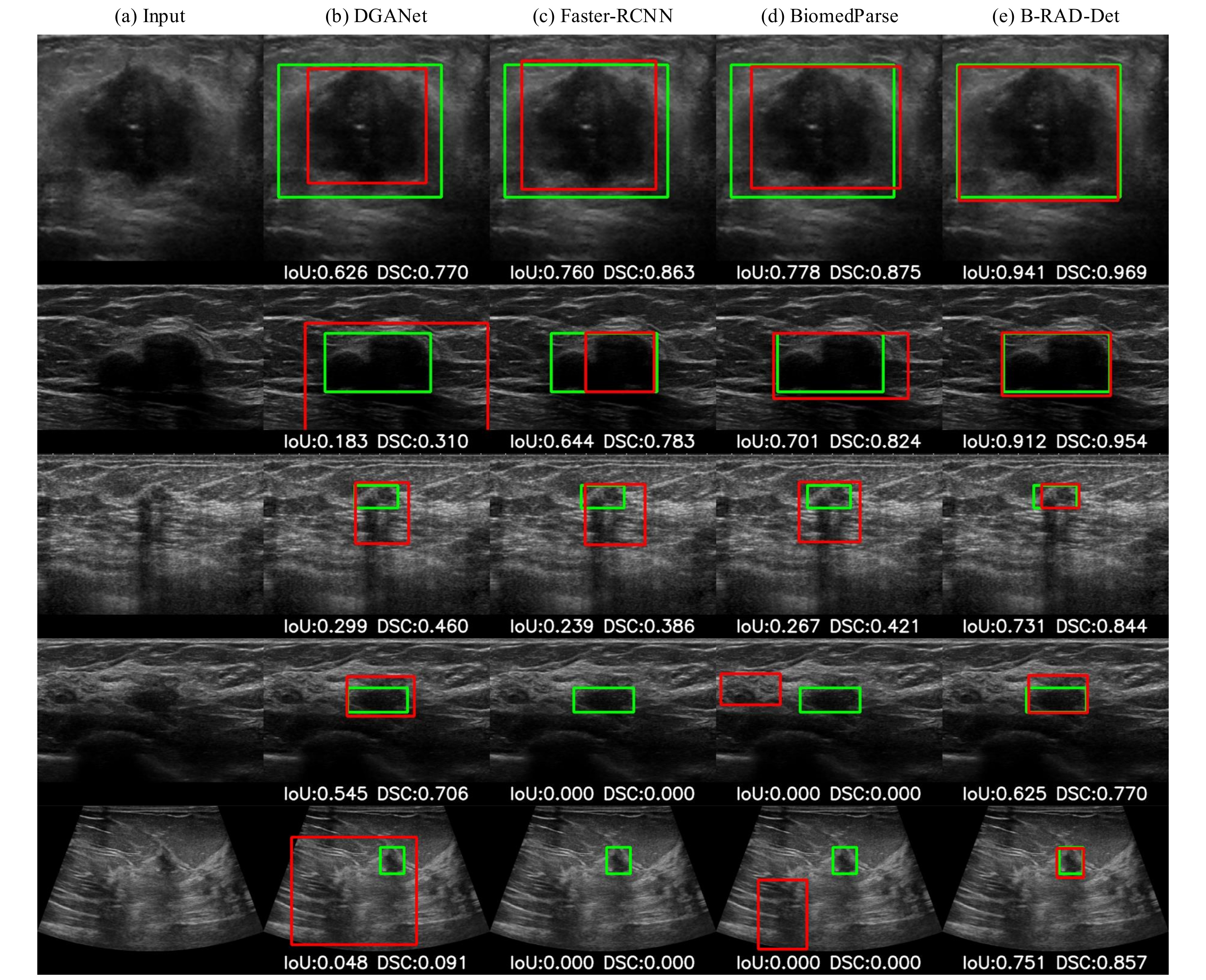 Few-shot lesion detection compared with baselines