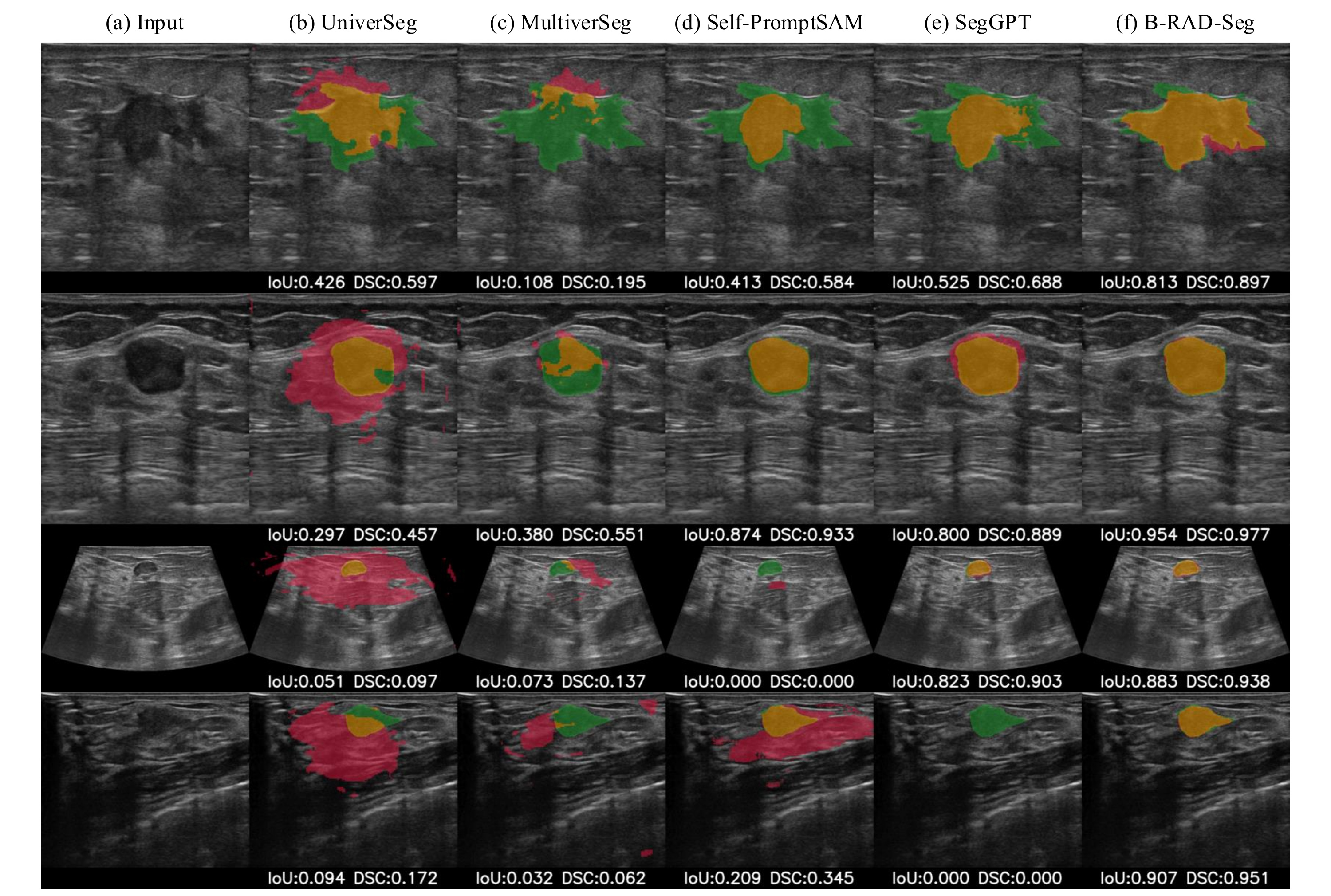 Few-shot segmentation masks compared with baselines