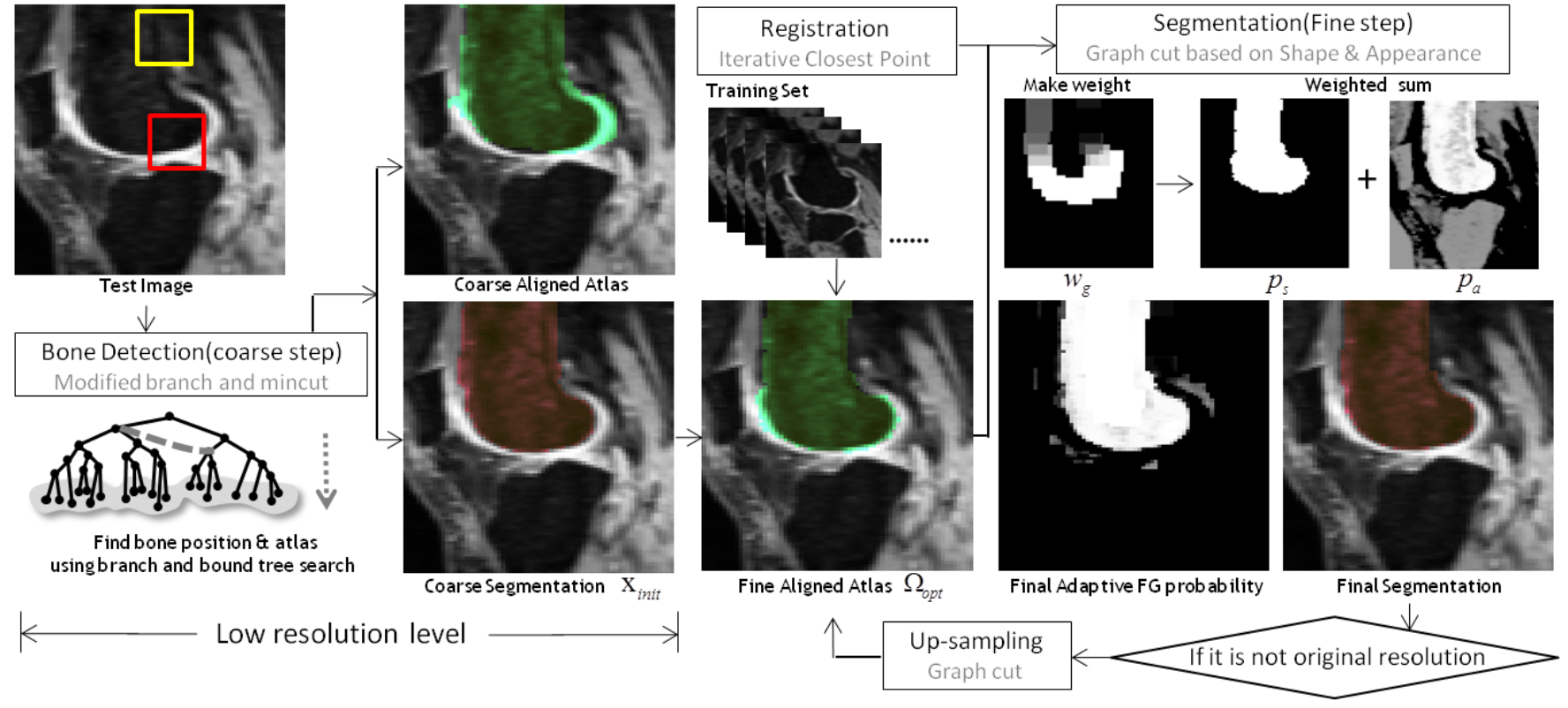 Automatic bone segmentation in knee MR images using a coarse-to-fine strategy.