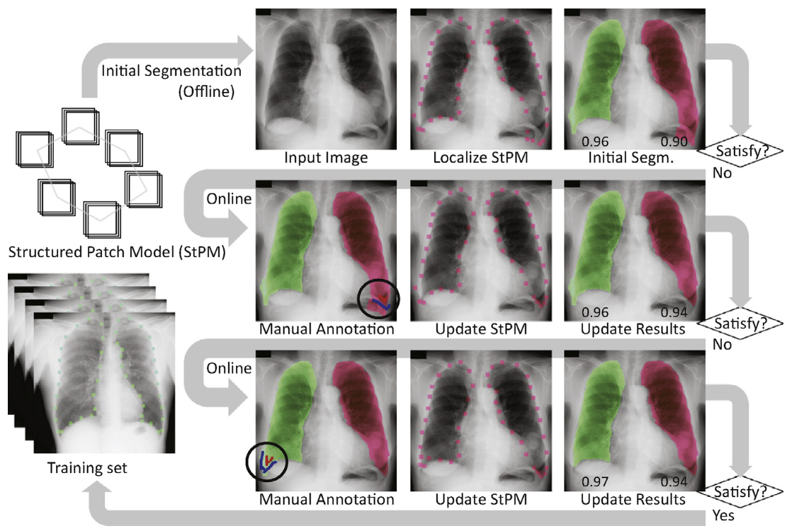 Structured patch model for a unified automatic and interactive segmentation framework.