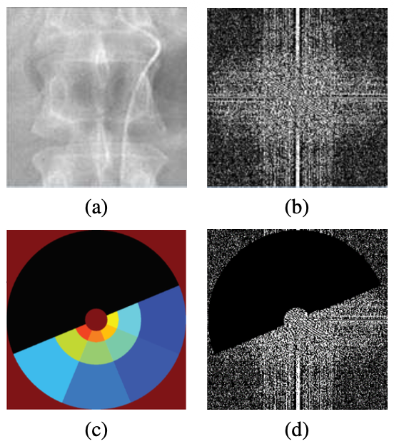 Phase-based nonrigid deformation for digital subtraction angiography.