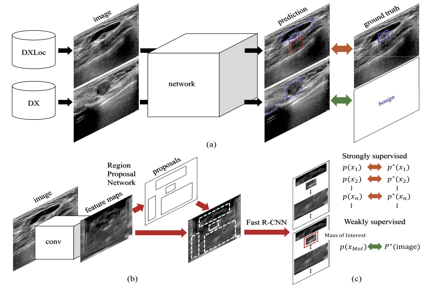 Joint weakly and semi-supervised deep learning for localization and classification of masses in breast ultrasound images.