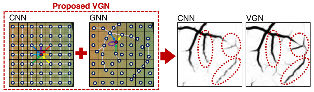 Deep vessel segmentation by learning graphical connectivity.