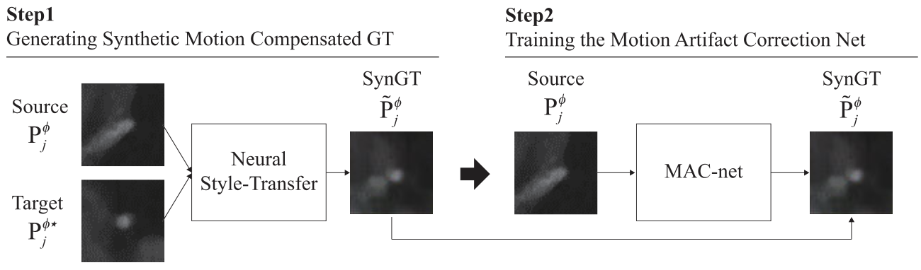 Deep learning cross-phase style transfer for motion artifact correction in coronary computed tomography angiography.