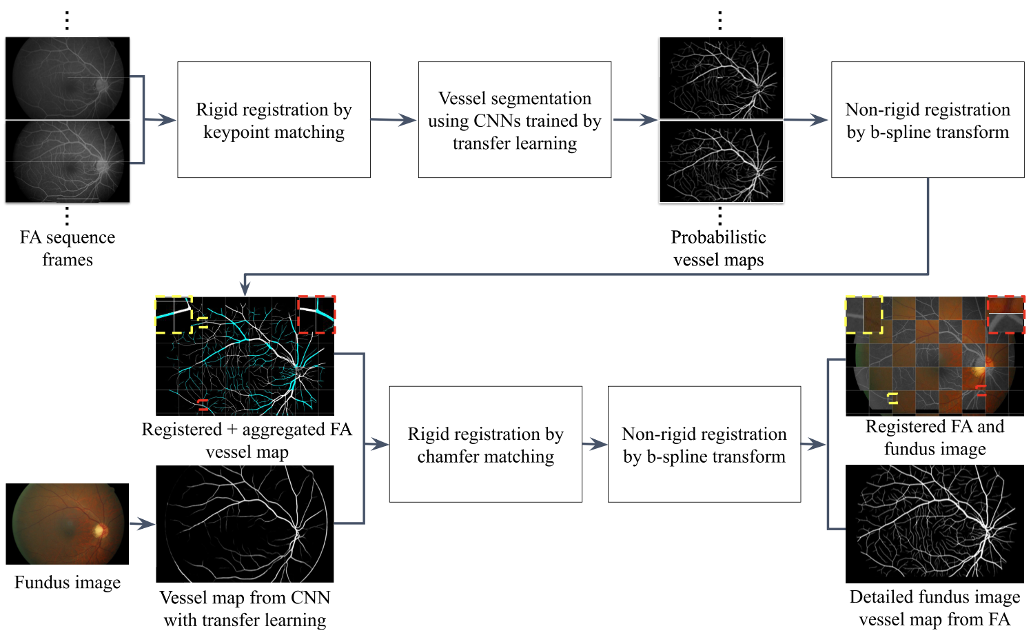 Multimodal registration of fundus images with fluorescein angiography for fine-scale vessel segmentation.