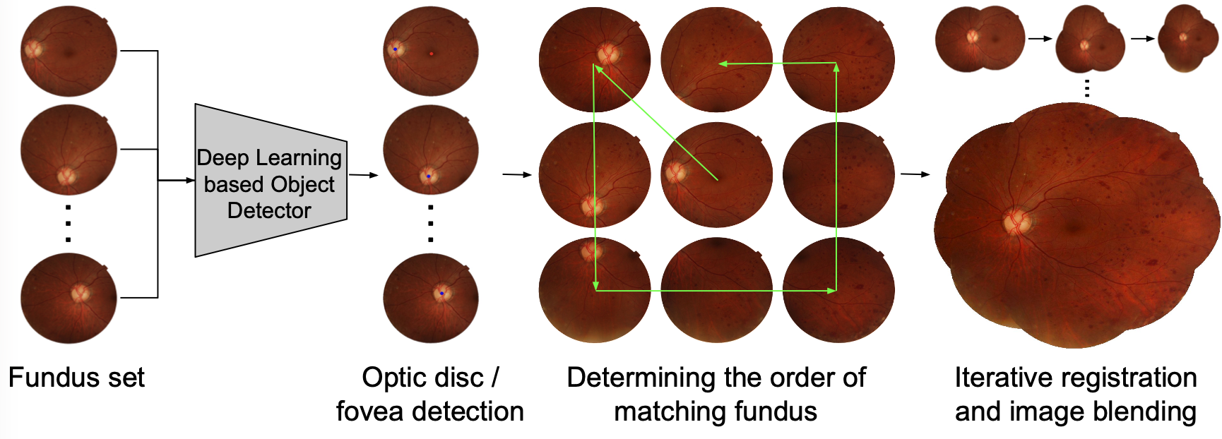 Fully leveraging deep learning methods for constructing retinal fundus photomontages.