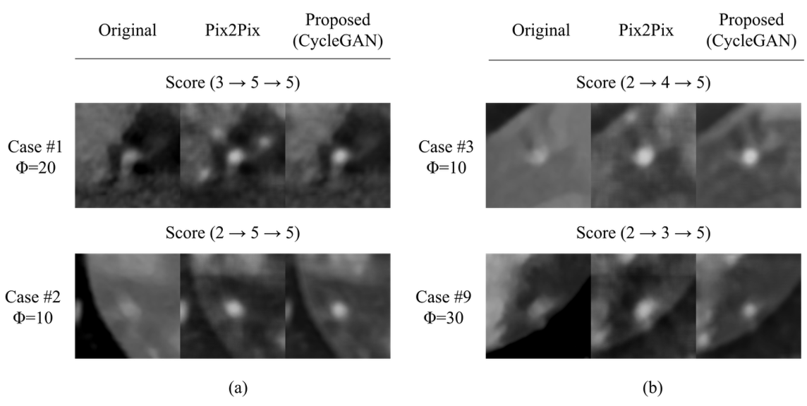 Cycle consistent generative motion artifact correction in coronary computed tomography angiography