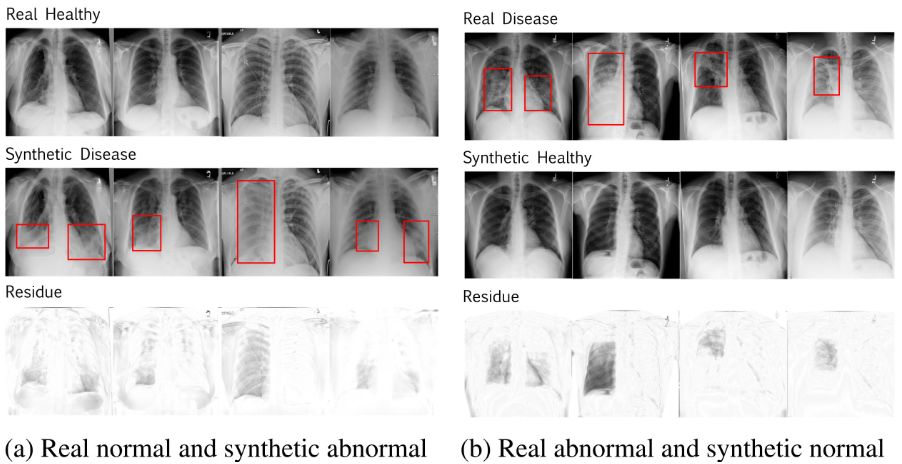 Disentangled contrastive learning from synthetic matching pairs for targeted chest X-ray generation