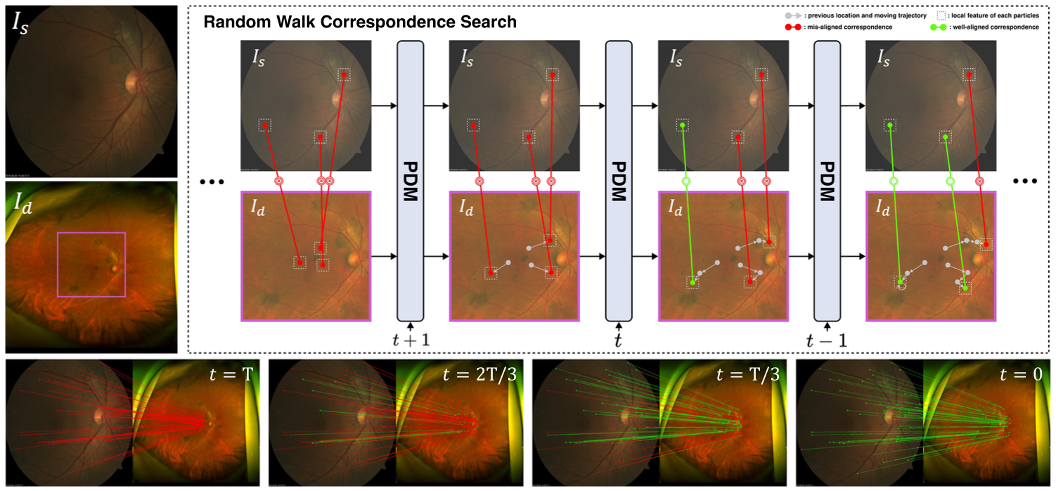 Particle Diffusion Matching: Random Walk Correspondence Search for the Alignment of Standard and Ultra-Widefield Fundus Images